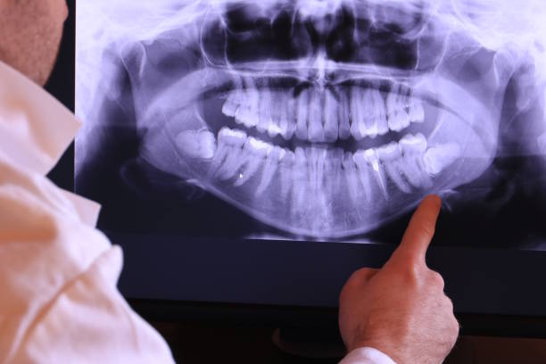 Best Emergency Treatment for Dental Infections or Abscesses in Hawkins, TX