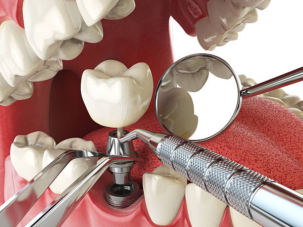 Best Emergency Denture Repair in Hawkins, TX